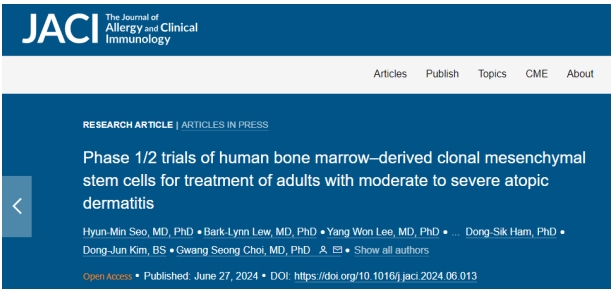 干细胞治疗特应性皮炎