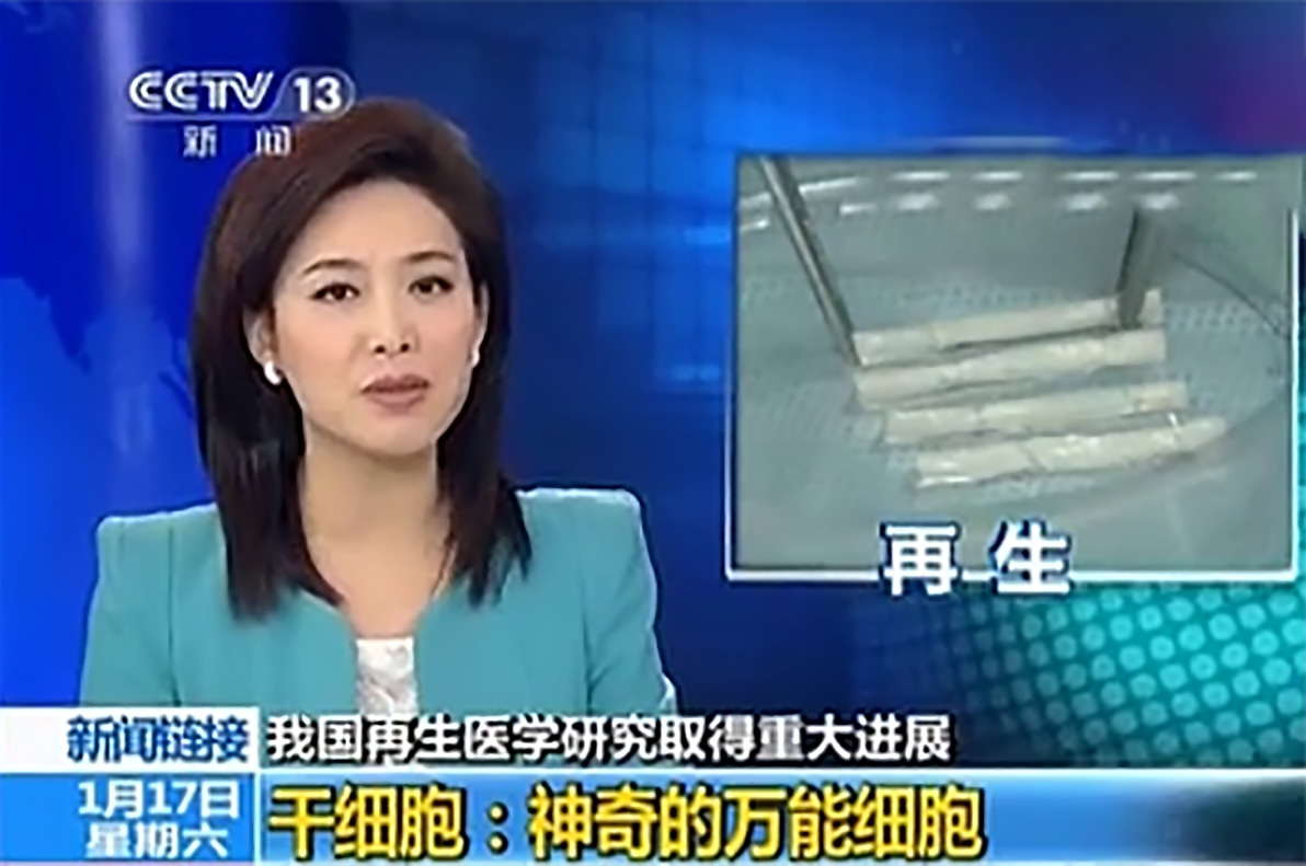 干细胞疗法